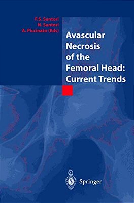 Avascular Necrosis Of The Femoral Head: Current Trends: Current Trends-..