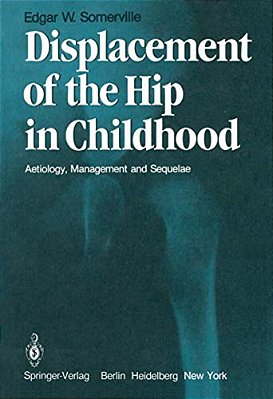 Displacement Of The Hip In Childhood: Aetiology, Management And Sequelae-..