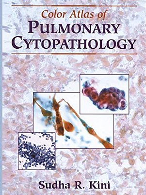 Color Atlas Of Pulmonary Cytopathology-..
