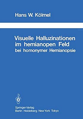 Visuelle Halluzinationen Im Hemianopen Feld Bei Homonymer Hemianopsie-..