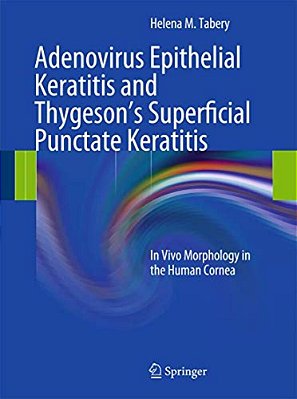 Adenovirus Epithelial Keratitis And Thygeson's Superficial Punctate Keratitis: In Vivo Morphology In The Human Cornea-..