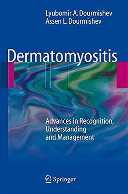 Dermatomyositis: Advances In Recognition, Understanding And Management-..