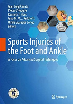 Sports Injuries Of The Foot And Ankle: A Focus On Advanced Surgical Techniques-..