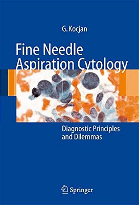 Fine Needle Aspiration Cytology: Diagnostic Principles And Dilemmas-..