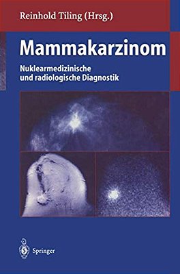 Mammakarzinom: Nuklearmedizinische Und Radiologische Diagnostik-..