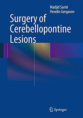 Surgery Of Cerebellopontine Lesions-..