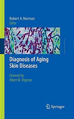 Diagnosis Of Aging Skin Diseases-..