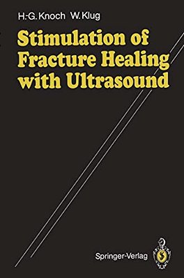 Stimulation Of Fracture Healing With Ultrasound-..