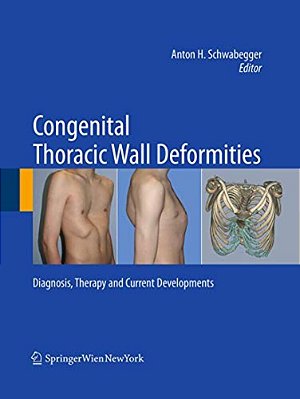 Congenital Thoracic Wall Deformities: Diagnosis, Therapy And Current Developments-..