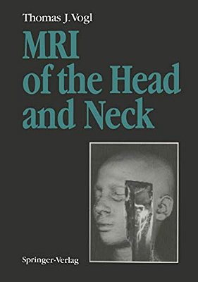 Mri Of The Head And Neck: Functional Anatomy -- Clinical Findings -- Pathology -- Imaging-..