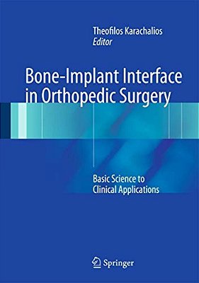 Bone-Implant Interface In Orthopedic Surgery: Basic Science To Clinical Applications-..