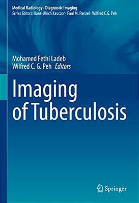 Imaging Of Tuberculosis-..