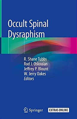 Occult Spinal Dysraphism-..