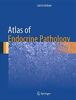Atlas Of Endocrine Pathology-..