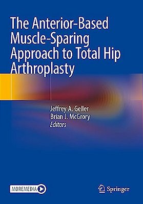 The Anterior-Based Muscle-Sparing Approach To Total Hip Arthroplasty-..