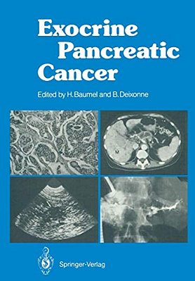 Exocrine Pancreatic Cancer-..