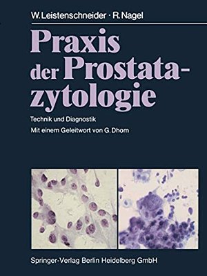 Praxis Der Prostatazytologie: Technik Und Diagnostik-..