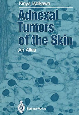 Adnexal Tumors Of The Skin: An Atlas-..