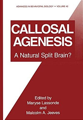 Callosal Agenesis: A Natural Split Brain?-..