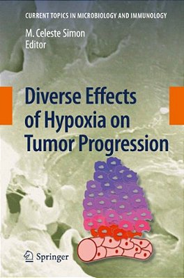 Diverse Effects Of Hypoxia On Tumor Progression-..