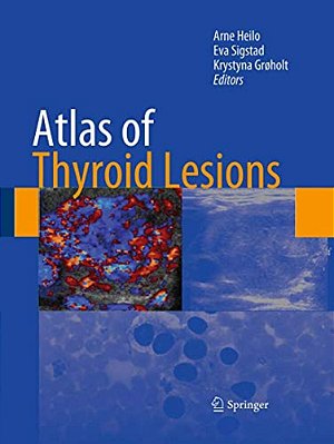 Atlas Of Thyroid Lesions-..