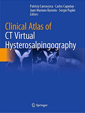 Clinical Atlas Of Ct Virtual Hysterosalpingography-..