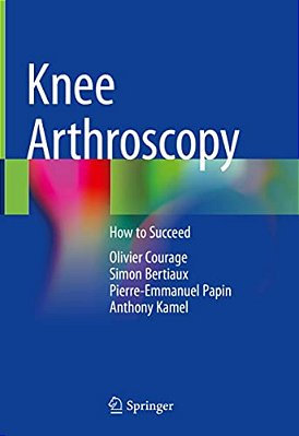 Knee Arthroscopy: How To Succeed-..