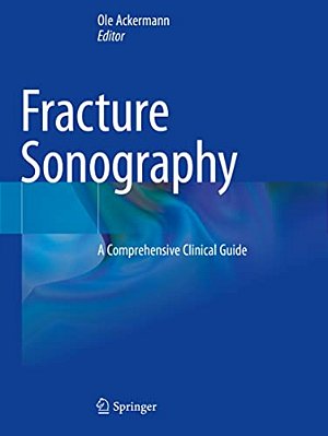 Fracture Sonography: A Comprehensive Clinical Guide-..