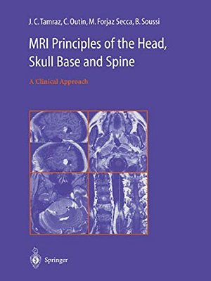 Mri Principles Of The Head, Skull Base And Spine: A Clinical Approach-..