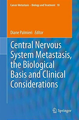 Central Nervous System Metastasis, The Biological Basis And Clinical Considerations-..