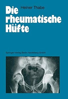 Die Rheumatische Hüfte-..