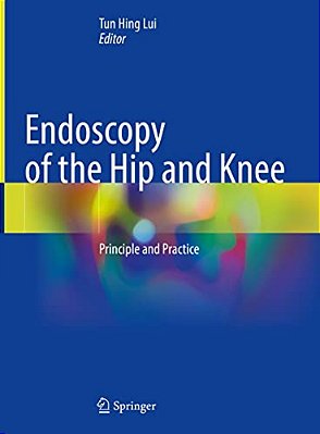 Endoscopy Of The Hip And Knee: Principle And Practice-..
