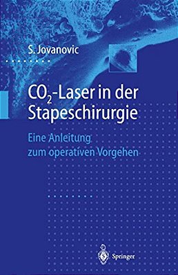 CO2-Laser In Der Stapeschirurgie: Eine Anleitung Zum Operativen Vorgehen-..