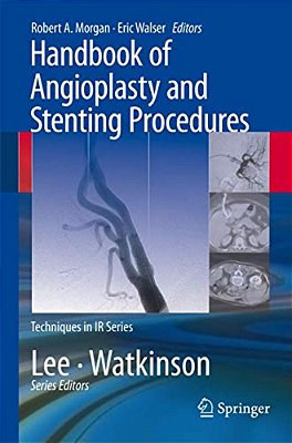 Handbook Of Angioplasty And Stenting Procedures-..