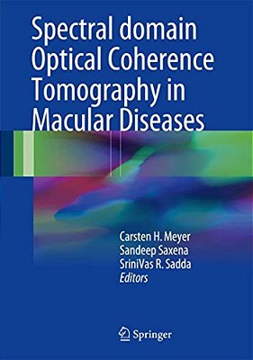 Spectral Domain Optical Coherence Tomography In Macular Diseases-..
