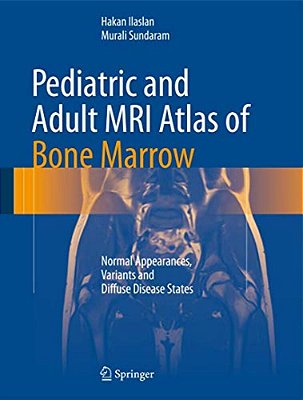Pediatric And Adult Mri Atlas Of Bone Marrow: Normal Appearances, Variants And Diffuse Disease States-..