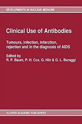 Clinical Use Of Antibodies: Tumours, Infection, Infarction, Rejection And In The Diagnosis Of Aids-..