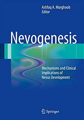 Nevogenesis: Mechanisms And Clinical Implications Of Nevus Development-..