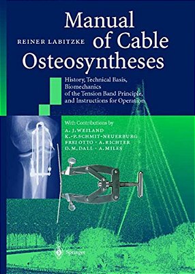 Manual Of Cable Osteosyntheses: History, Technical Basis, Biomechanics Of The Tension Band Principle, And Instructions For Operation-..
