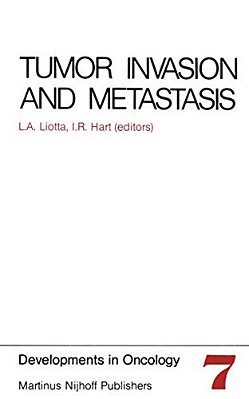 Tumor Invasion And Metastasis-..