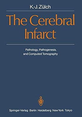 The Cerebral Infarct: Pathology, Pathogenesis, And Computed Tomography-..