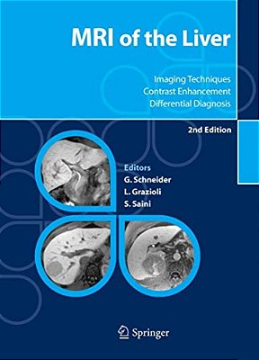 Mri Of The Liver: Imaging Techniques, Contrast Enhancement, Differential Diagnosis-..