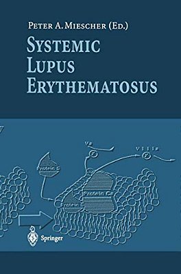 Systemic Lupus Erythematosus-..