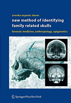 New Method Of Identifying Family Related Skulls: Forensic Medicine, Anthropology, Epigenetics-..