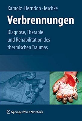 Verbrennungen: Diagnose, Therapie Und Rehabilitation Des Thermischen Traumas-..