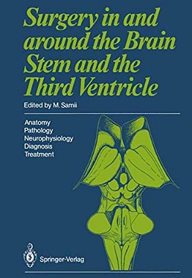 Surgery In And Around The Brain Stem And The Third Ventricle: Anatomy - Pathology - Neurophysiology Diagnosis - Treatment-..