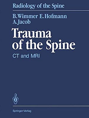 Trauma Of The Spine: Ct And Mri-..