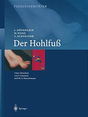 Fussdeformitäten: Der Hohlfuss-..