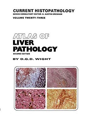 Atlas Of Liver Pathology-..