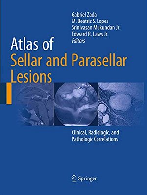 Atlas Of Sellar And Parasellar Lesions: Clinical, Radiologic, And Pathologic Correlations-..